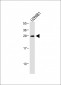 IGLL5 Antibody (C-term)